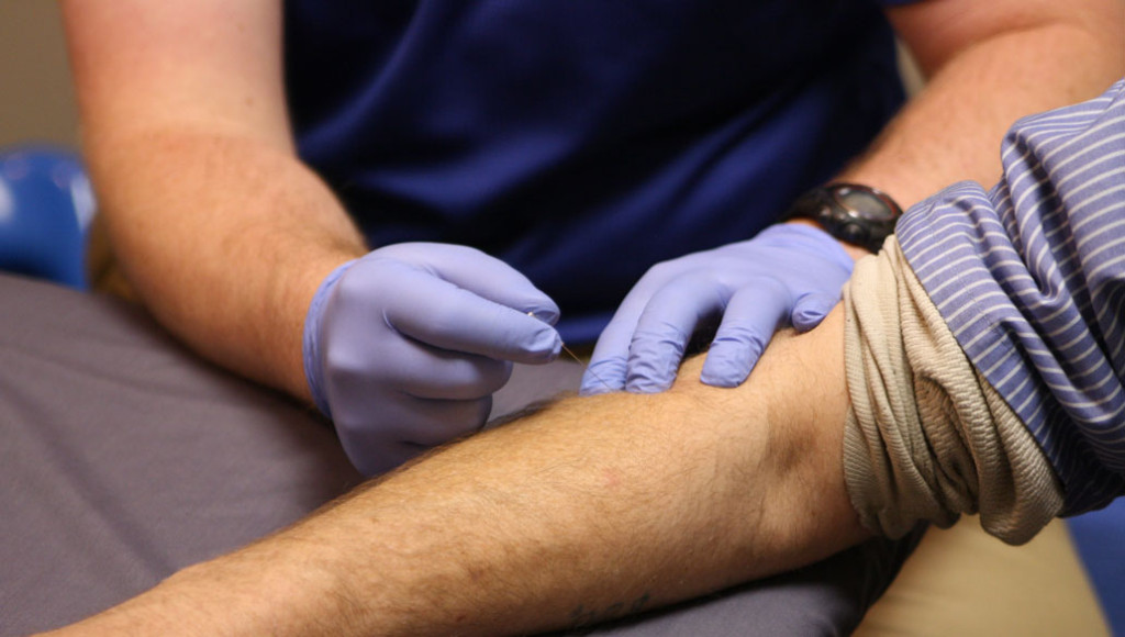 dry needling hastings ne